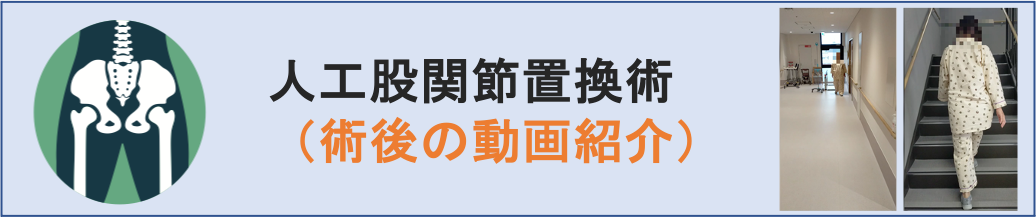 股関節の疾患・治療